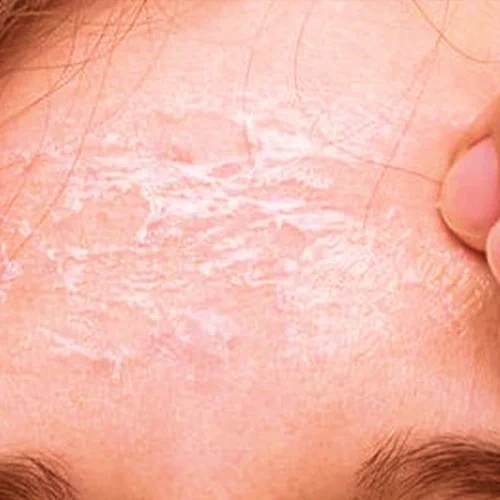 روتین پوست خشک و کم آب 2 skin1