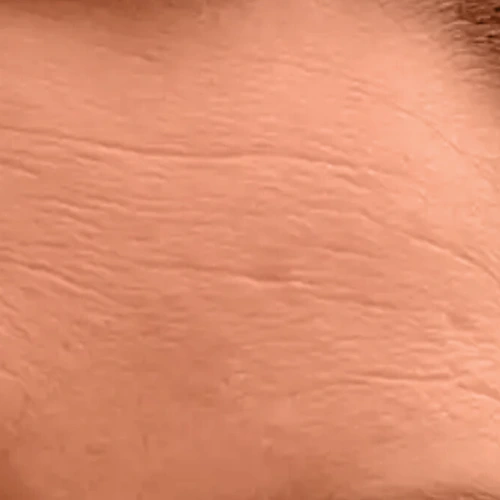 روتین پوست خشک و کم آب 3 skin2