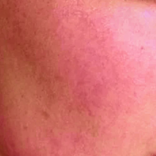 skin1