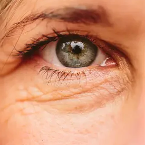 روتین پوستی ضد چروک و جوان ساز 3 skin2