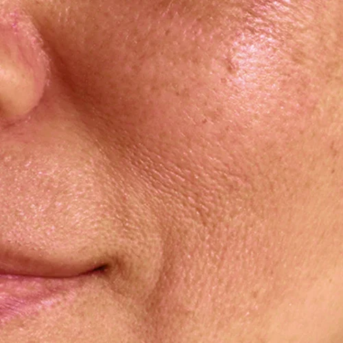 روتین پوستی ضد چروک و جوان ساز 4 skin3